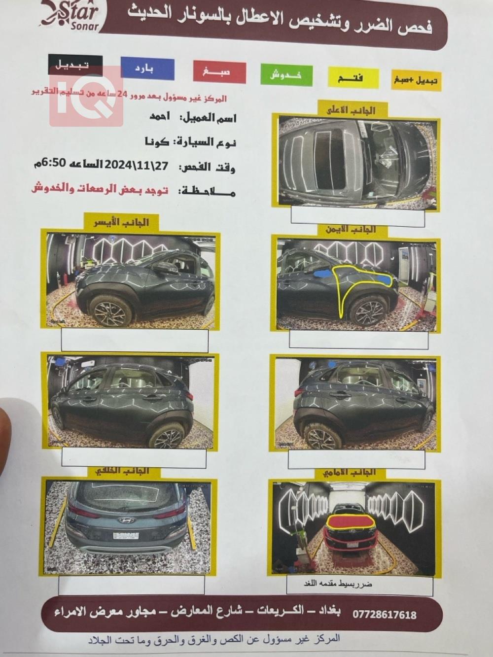 هيونداي كونا